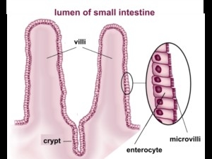 intestinal villi celiac disease